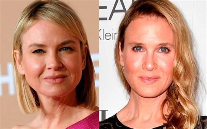 Celebrity plastic surgery disasters Fox News